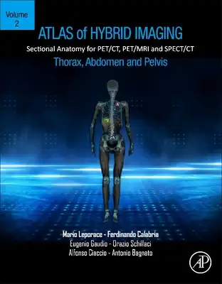 Atlas of Hybrid Imaging Sectional Anatomy for Pet/Ct, Pet/MRI and Spect ...